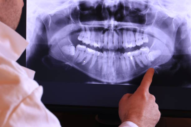 Best Emergency Dentist for Knocked-Out Tooth in Panacea, FL