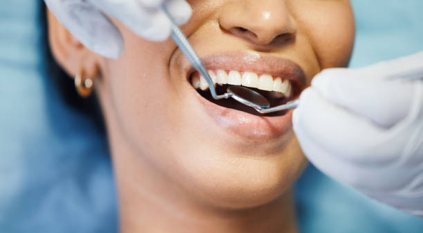 Best Emergency Dental Services for Seniors in Panacea, FL